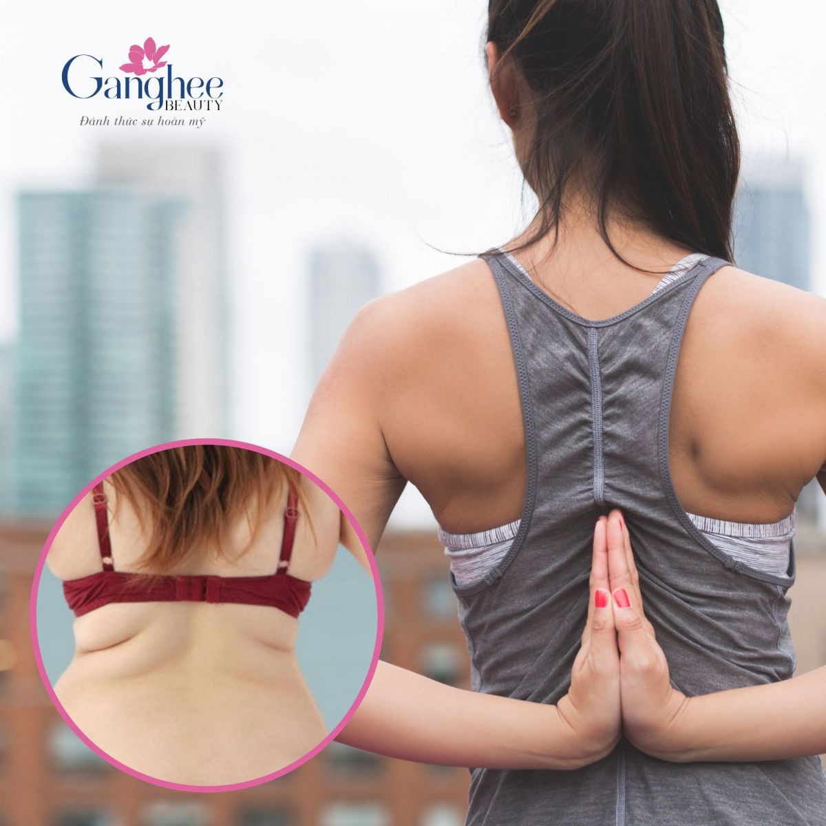 Giảm béo vùng lưng xoài Ganghee